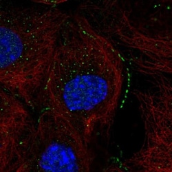 THEM2 Antibody, Novus Biologicals 0.1mL; Unlabeled:Antibodies, Polyclonal